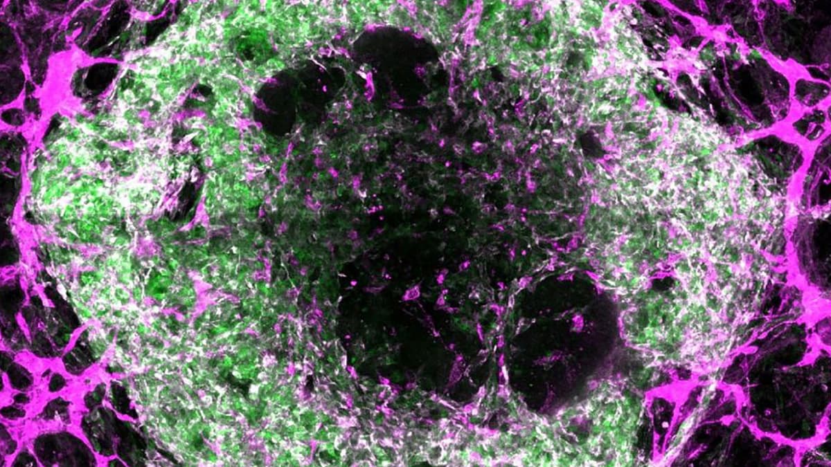 Peneliti Ciptakan Organoid dengan Pembuluh Darah untuk Organ Mini Lebih Sempurna