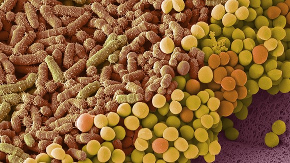 Bakteri Usus Baru Ditemukan Bisa Tingkatkan Efektivitas Terapi Kanker