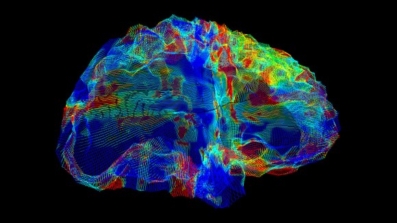 Varian Gen APOE ε4 Sebabkan Risiko Lebih Besar untuk Berbagai Penyakit Otak