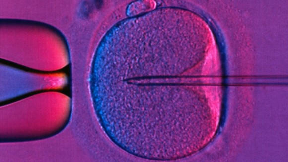 Teknik Tiga-DNA: Bayi Sehat Lahir dari Prosedur Mitochondrial Donation di Inggris