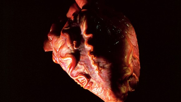 Metode Murah Baru Untuk Menghidupkan Kembali Jantung Anak Donor dan Tingkatkan Transplantasi