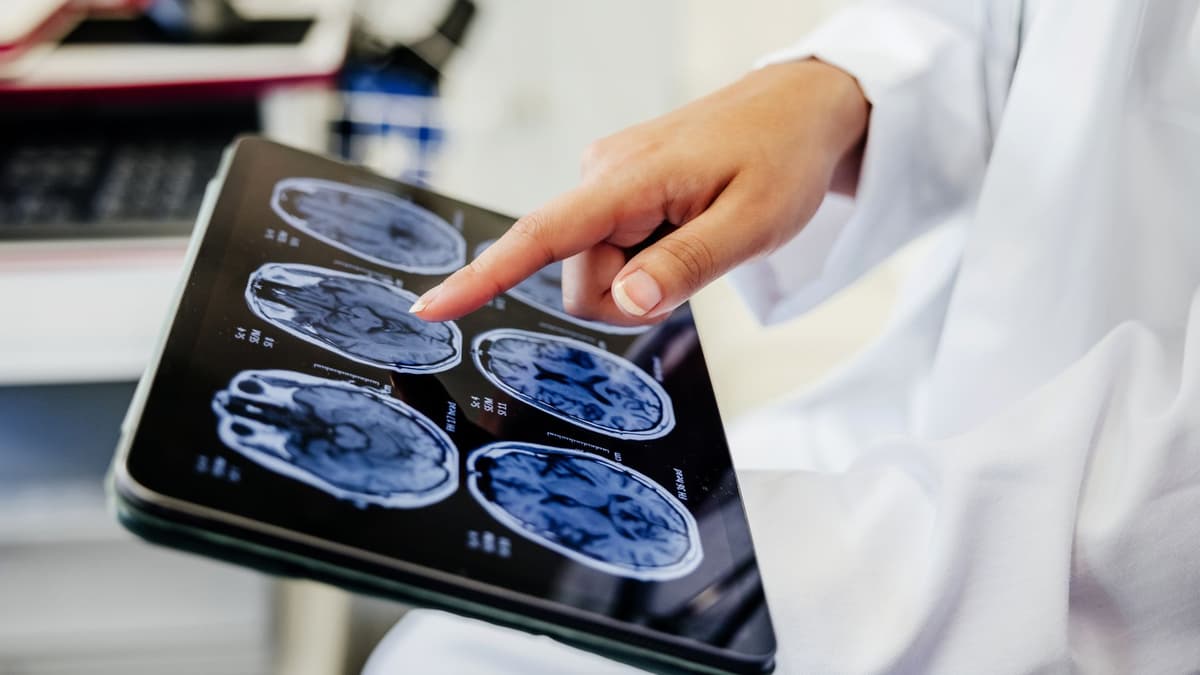 Nanoflowers Inovatif: Harapan Baru untuk Mengatasi Kerusakan Sel Otak