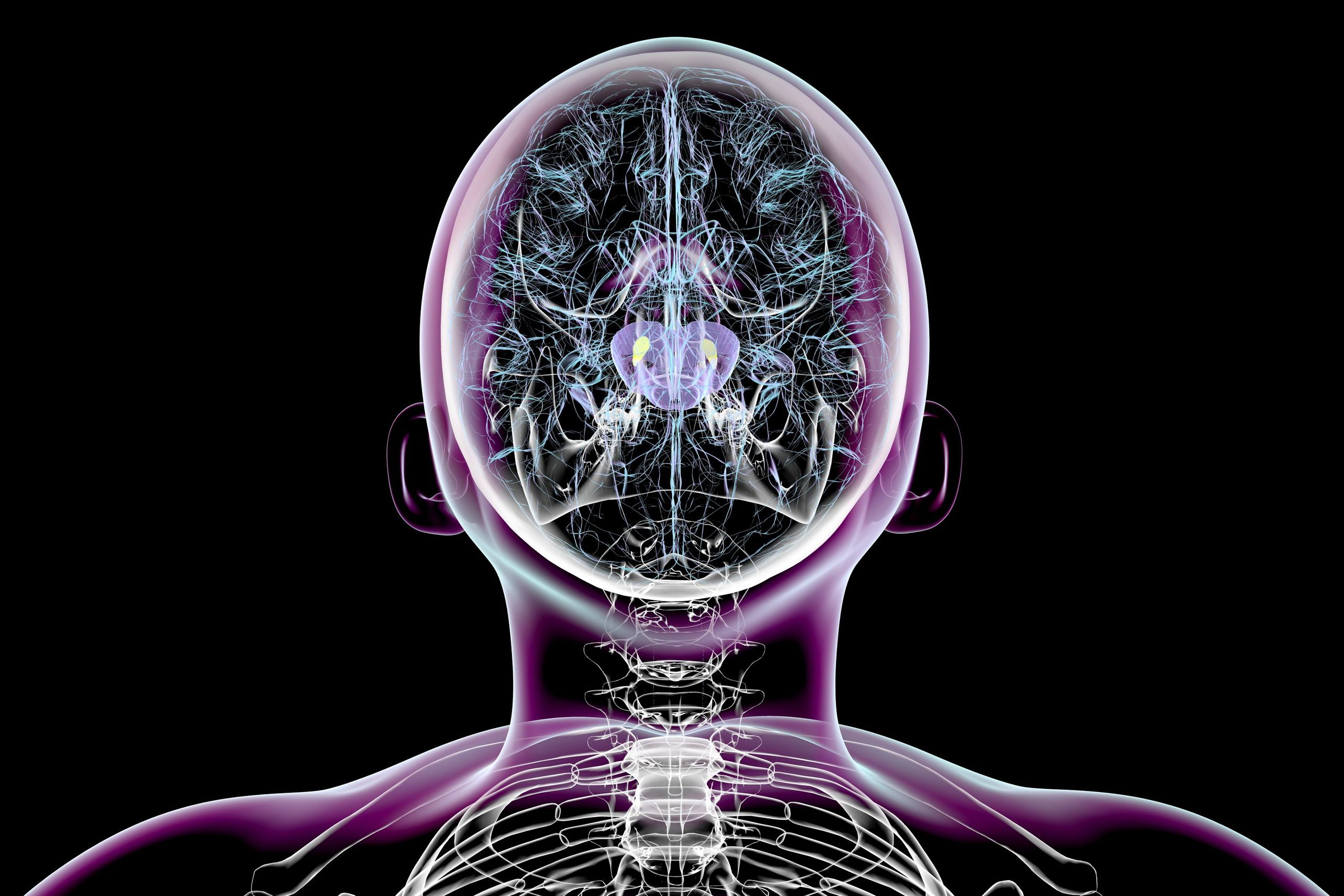 Terapi Baru Harapkan Perlambat Penyakit Parkinson Lewat Tembaga dan Genetik