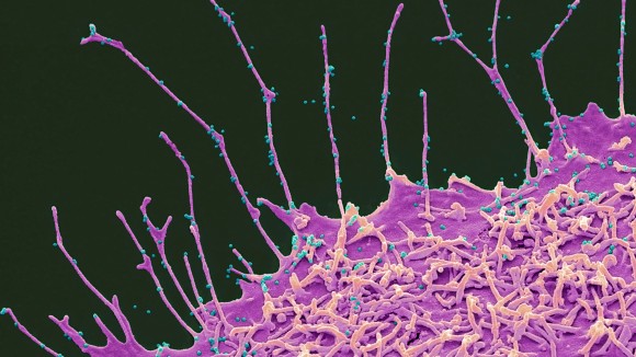 Pandemi COVID-19 Mempercepat Penuaan Otak Tanpa Infeksi Virus