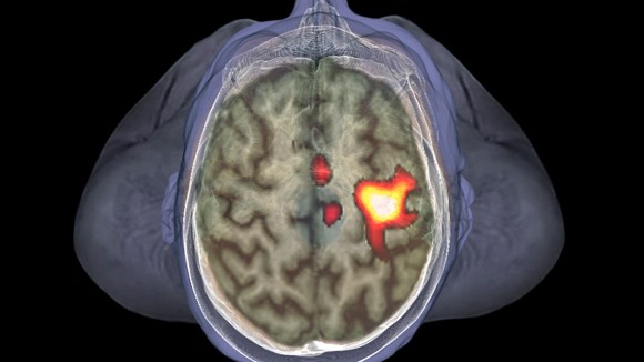 Otak Aktifkan Sel Imun Hanya dengan Melihat Orang Sakit Lewat VR