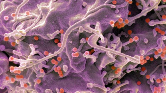 Vaksin mRNA Baru Tunjukkan Respon Kuat Melawan HIV dalam Uji Klinis Awal