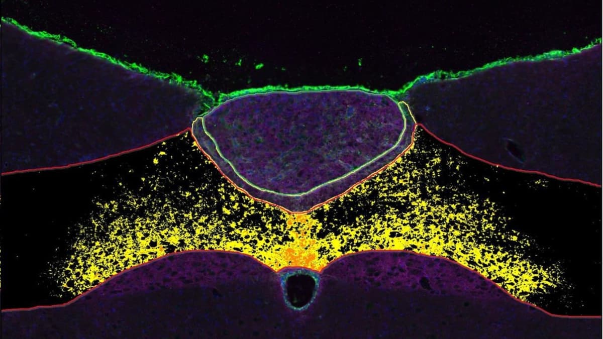 Obat Baru Dari Sel Pendukung Otak Atasi Obesitas Tanpa Efek Samping