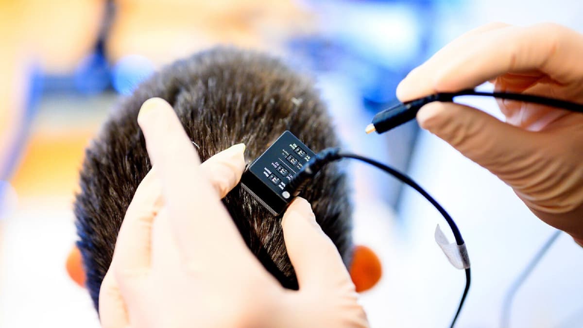 Teknologi Otak-Komputer Mengembalikan Suara Penderita Lumpuh Total Dengan AI Real-Time