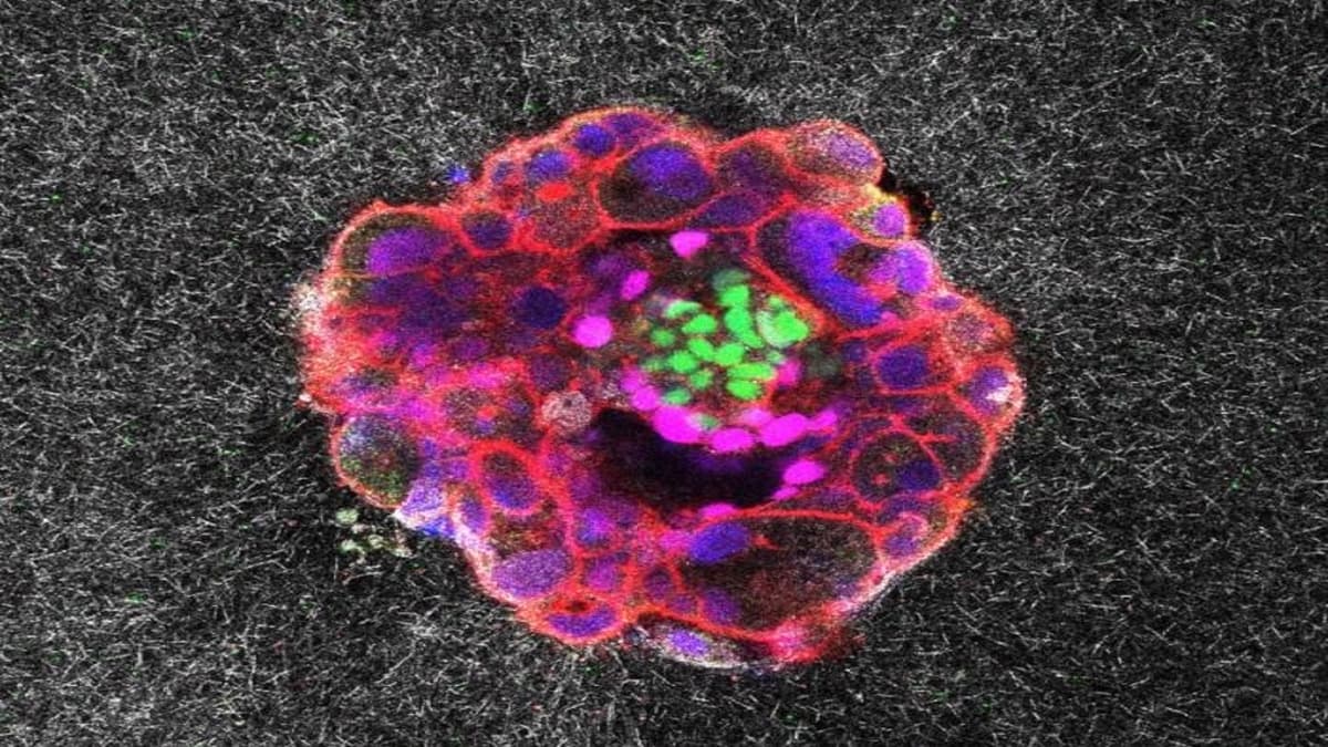 Penemuan Baru: Embrio Manusia Menanam Diri di Rahim dengan Kekuatan Memukau