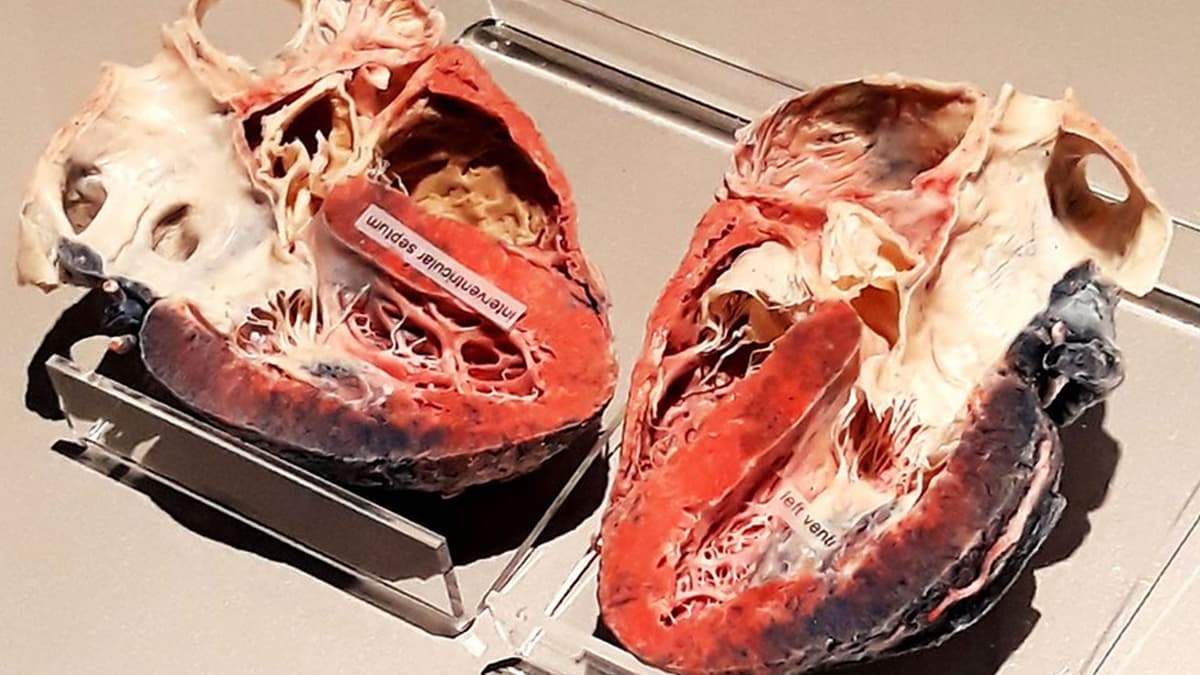 Teknik Baru Cairan Ionik Membuat Organ Transparan Perkaya Ilmu Kedokteran