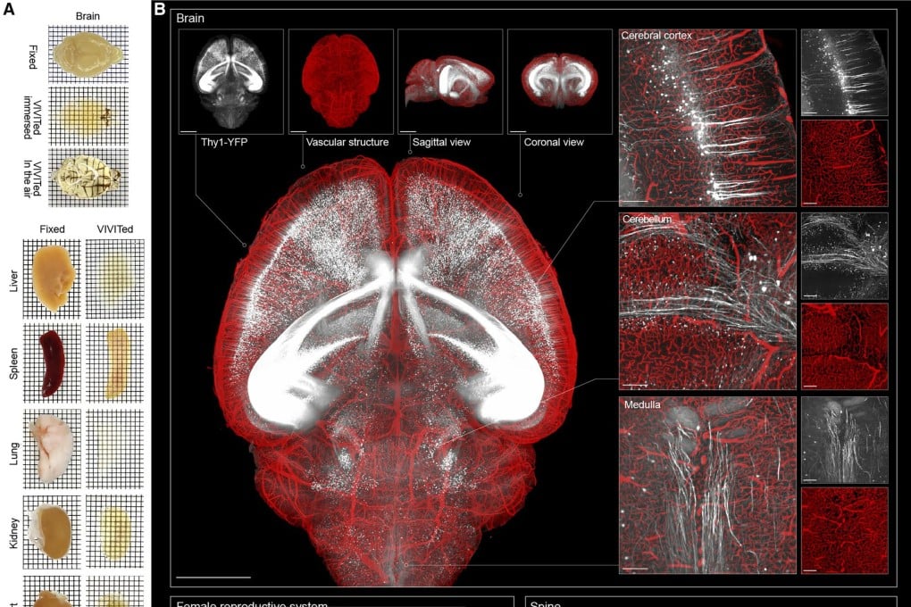Metode Baru Tsinghua Bikin Organ Jadi Transparan dan Gambar 3D Tajam