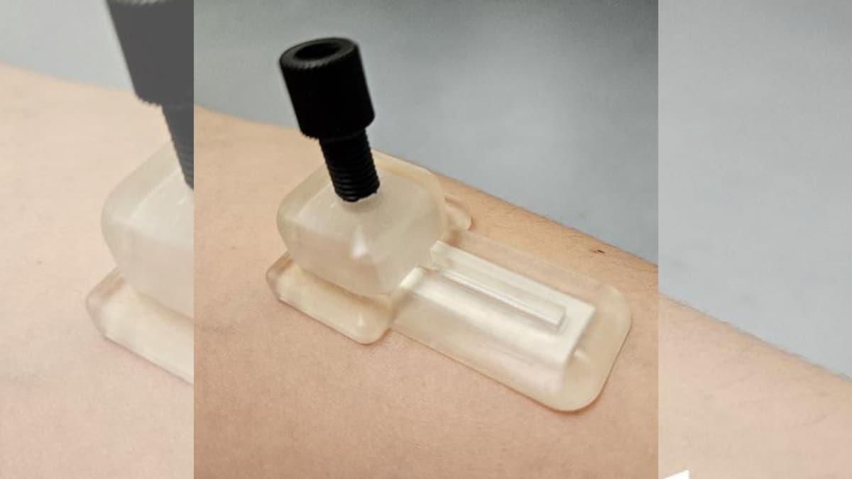 Patch Microneedle Tanpa Darah untuk Pantau Kesehatan dengan Mudah