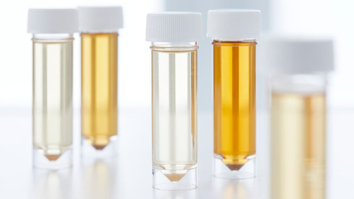 Urin Manusia Diubah Jadi Pupuk Tenaga Surya untuk Pertanian Berkelanjutan