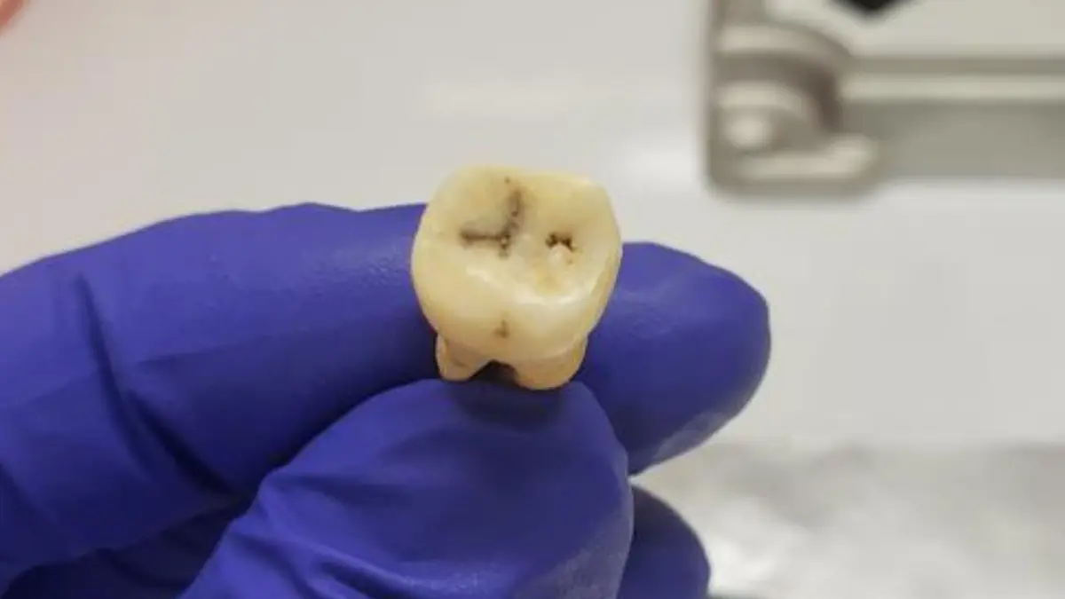 Penemuan Bakteri Penyebab Wabah Justinian di Kota Kuno Jerash