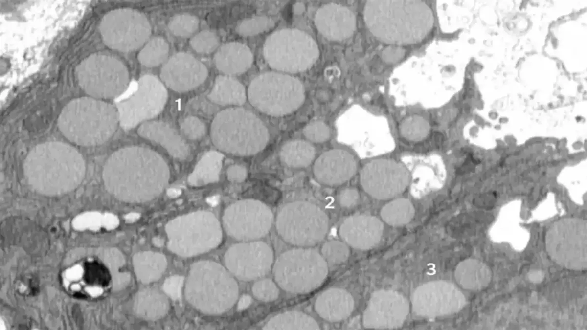 Sel ‘Muntah’ Untuk Cepat Sembuhkan Luka, Tapi Berisiko Kanker