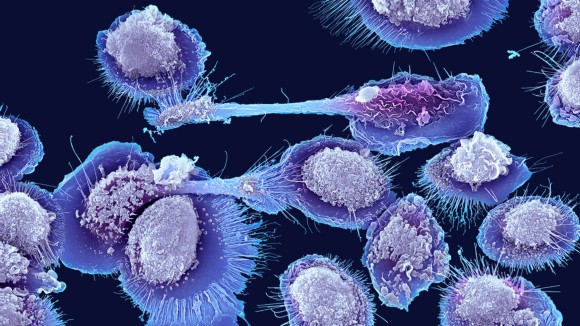 Sel Imun Baru di Lemak Memicu Peradangan pada Penuaan