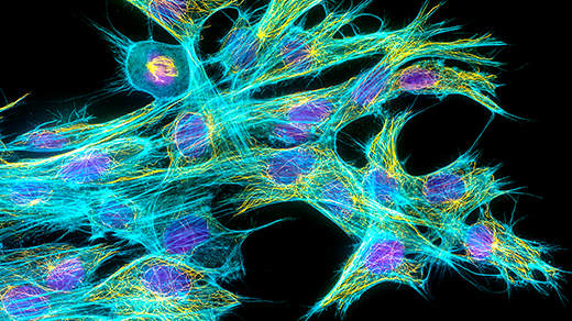 Penemuan Tubulin Pada Sel Asgard Mengungkap Asal Usul Sel Eukariotik