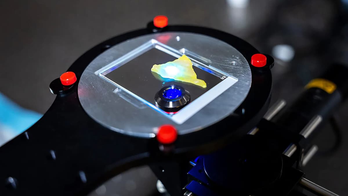 Teknologi Baru Memperlihatkan Perubahan Protein Tersembunyi di Sel Hidup Penyakit Alzheimer