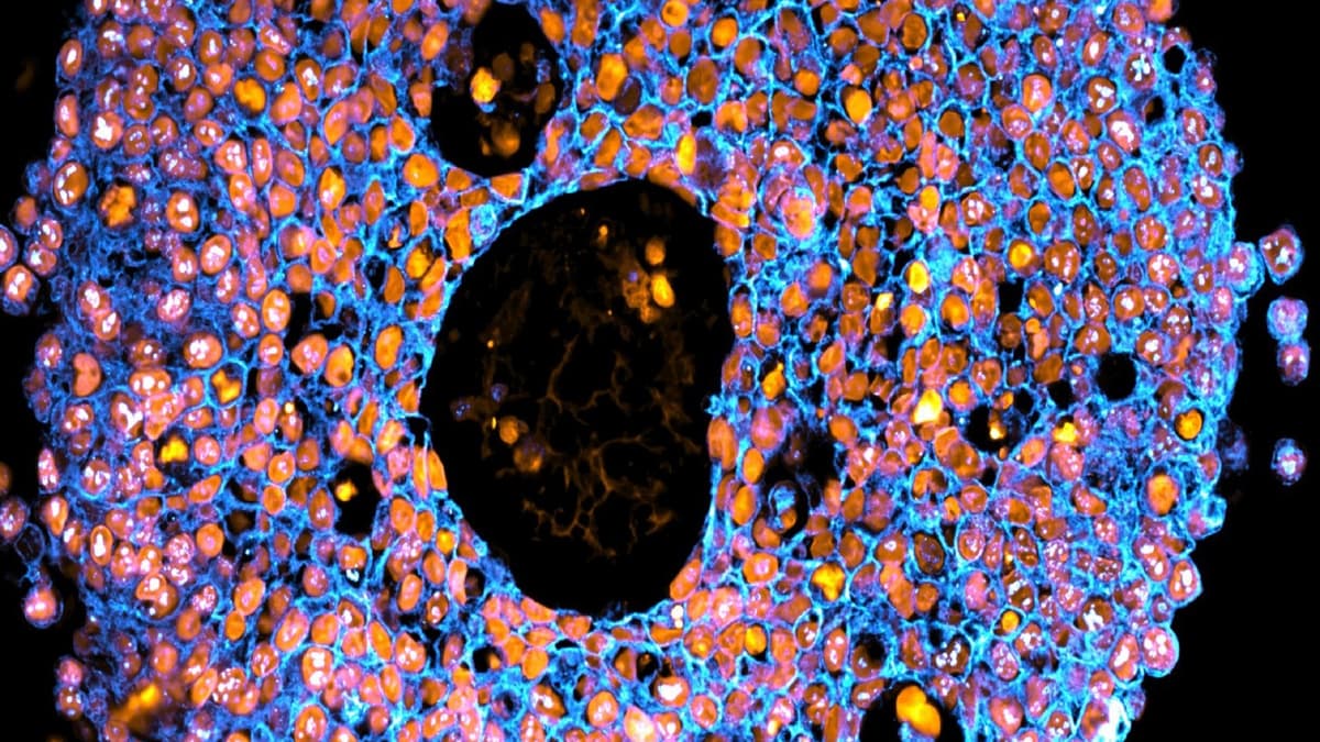 Terobosan 3D Bioprinting Miniatur Plasenta Bantu Pahami Komplikasi Kehamilan