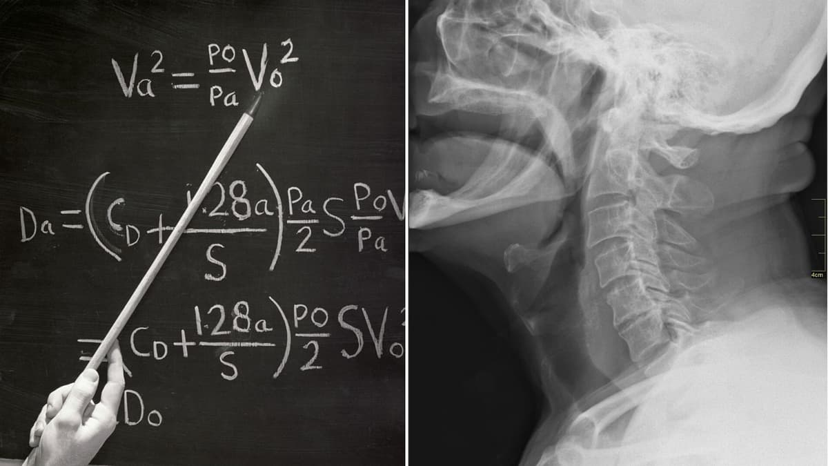 Model Matematika Baru Membantu Mengatasi Masalah Sulit Menelan dengan Akurat