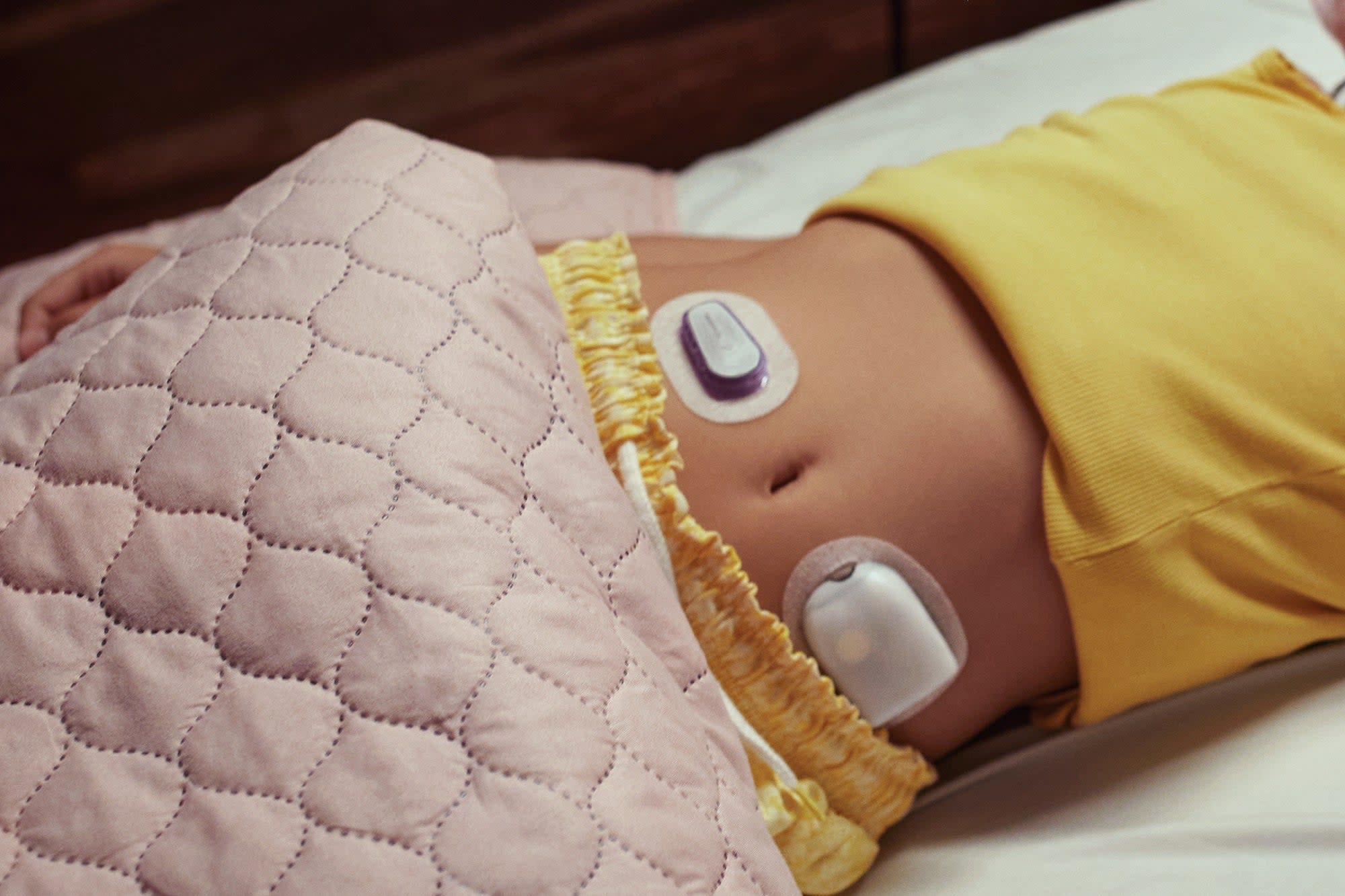 Insulet Ciptakan Warna Oranye Omnipod Mango untuk Lawan Dominasi Biru di Alat Diabetes