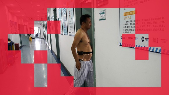 AI Besar China Bantu Atasi Penyakit Kronis dan Tekan Beban Kesehatan