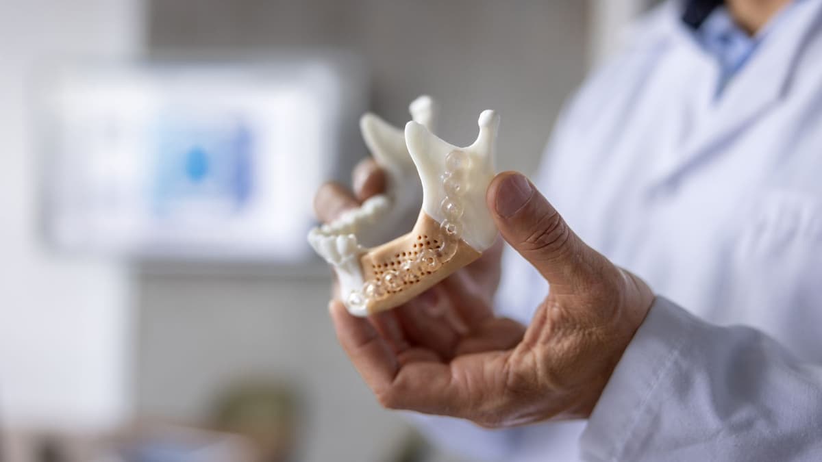 Kaca Bioaktif 3D Cetak Inovatif Bantu Pertumbuhan Tulang Lebih Lama