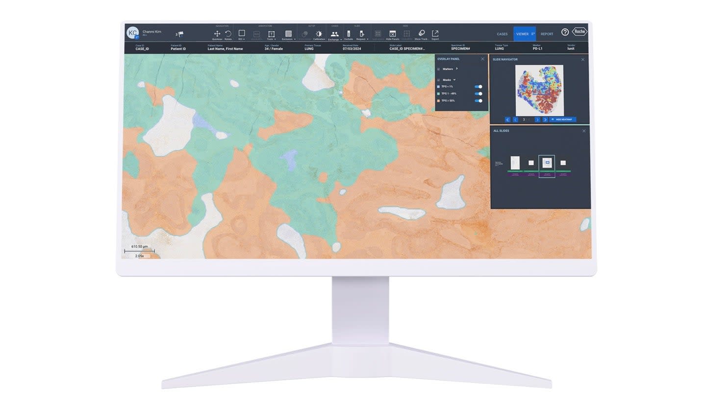 Lunit dan CellCarta Integrasikan AI Patologi untuk Uji Klinis Lebih Cepat dan Akurat
