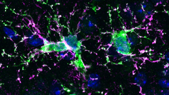 Terobosan Penggantian Mikroglia Bisa Redakan Penyakit Otak Serius