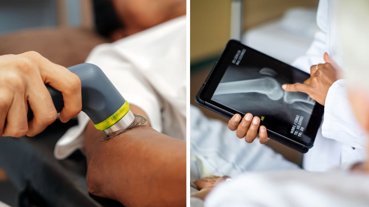 Alat Cetak Tulang Baru: Solusi Murah dan Cepat untuk Penyembuhan Patah Tulang