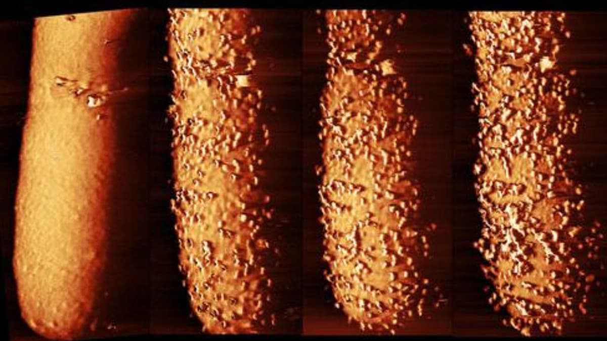 Bagaimana Antibiotik Polymyxin B Menembus Pertahanan Kuat Bakteri Gram-Negatif