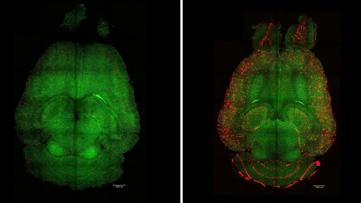Terobosan Nanoteknologi: Supramolecular Drugs Pulihkan Otak Alzheimer pada Tikus