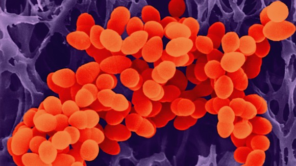 Krisis Global Antibiotik Baru dan Tantangan Melawan Resistensi Bakteri