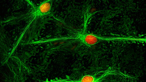 Penemuan Neuron Khusus Bisa Bantu Redakan Nyeri Kronis Secara Alami