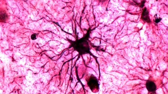 Astrocytes: Sel Otak Kunci Penstabil Memori Emosional Jangka Panjang