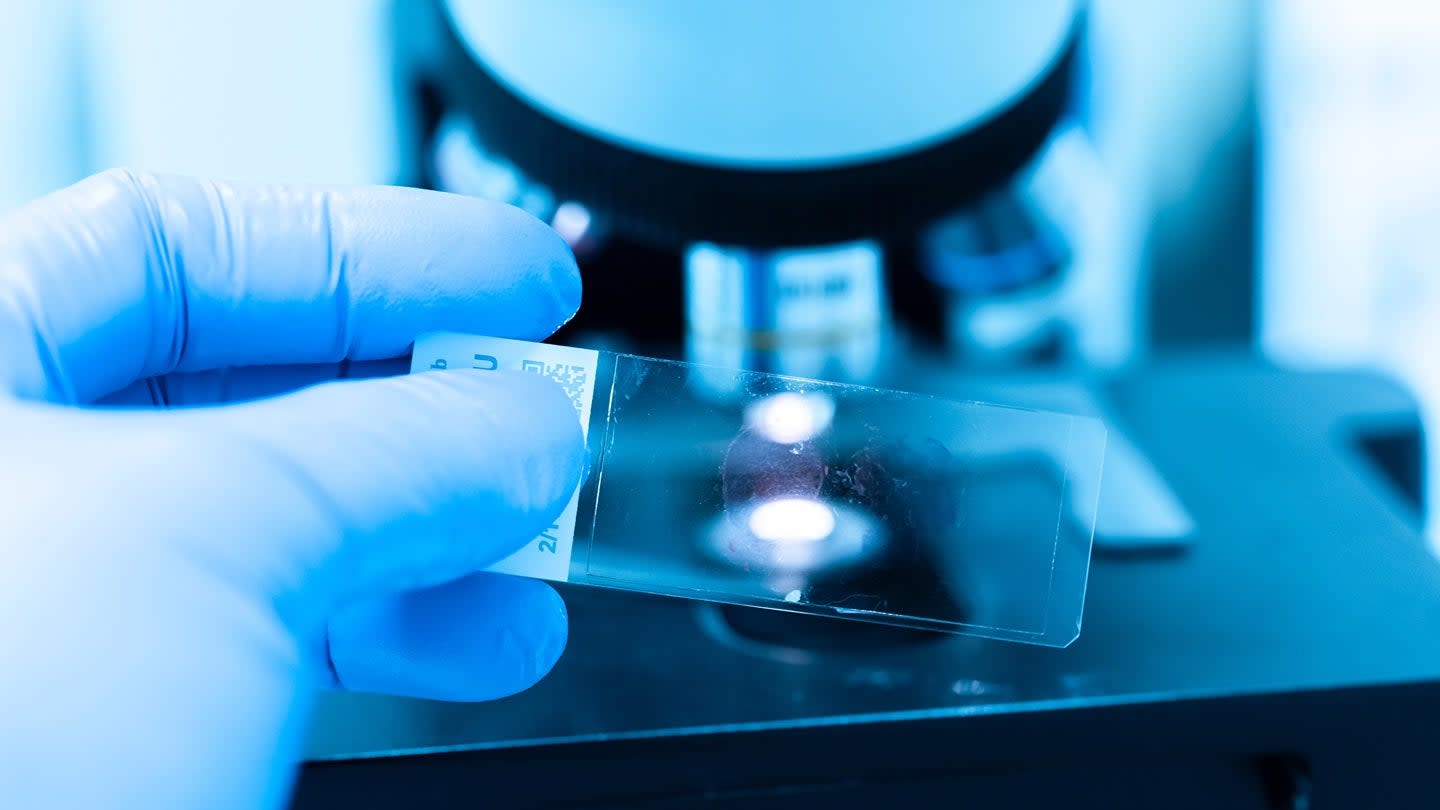 Tubulis Dapat Dana 361 Juta Dolar untuk Kembangkan Terapi Kanker Baru