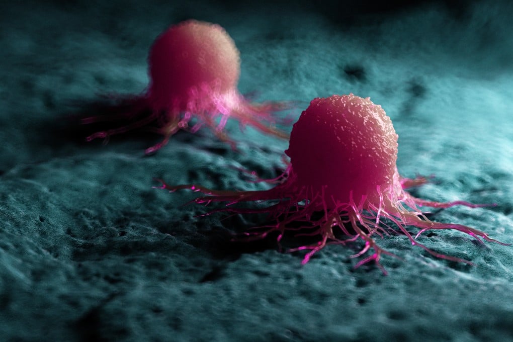 Penemuan Enzim Penguat Kanker Prostat Buka Jalan Terapi Baru