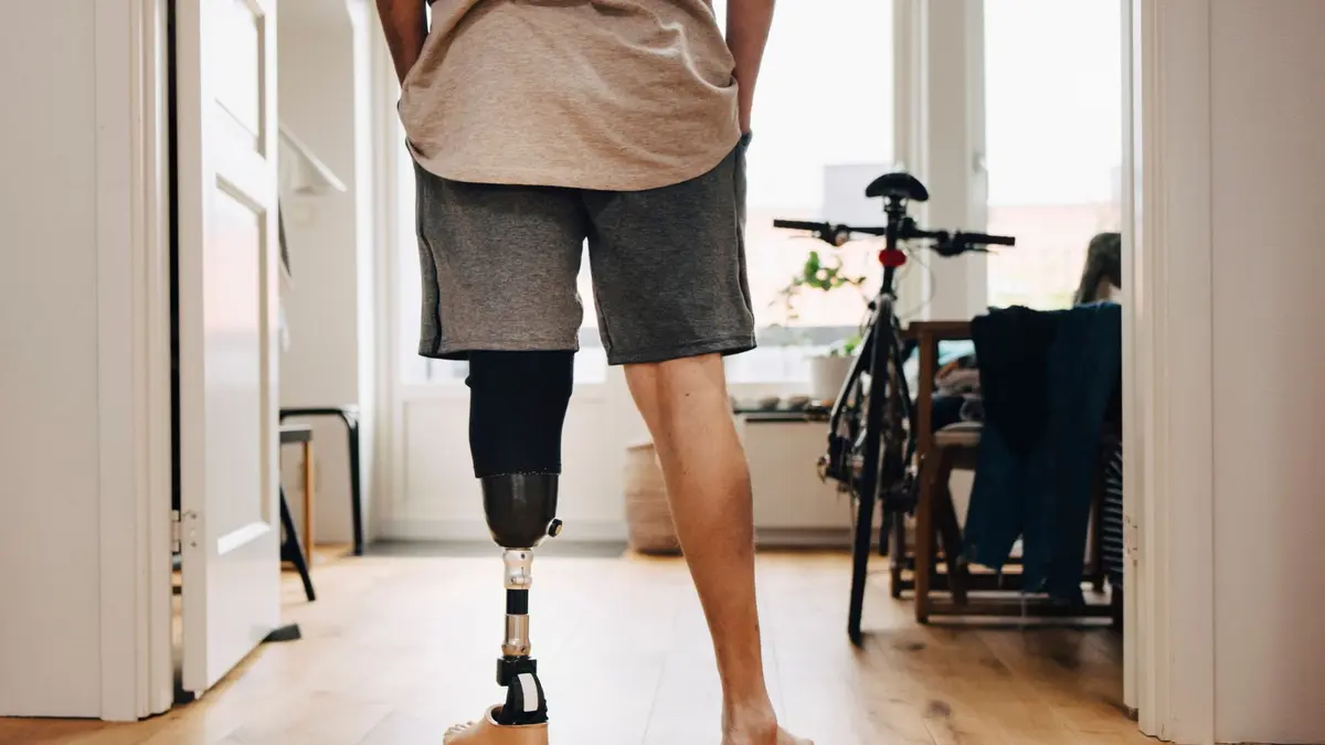 Terobosan Botox untuk Meredakan Nyeri Amputasi Perang di Ukraina