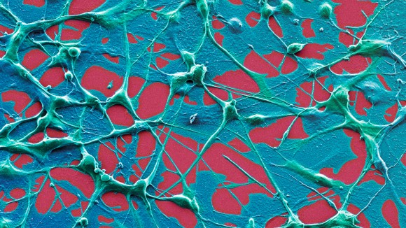 Vaksin mRNA COVID-19 Ternyata Bisa Perpanjang Hidup Pasien Kanker