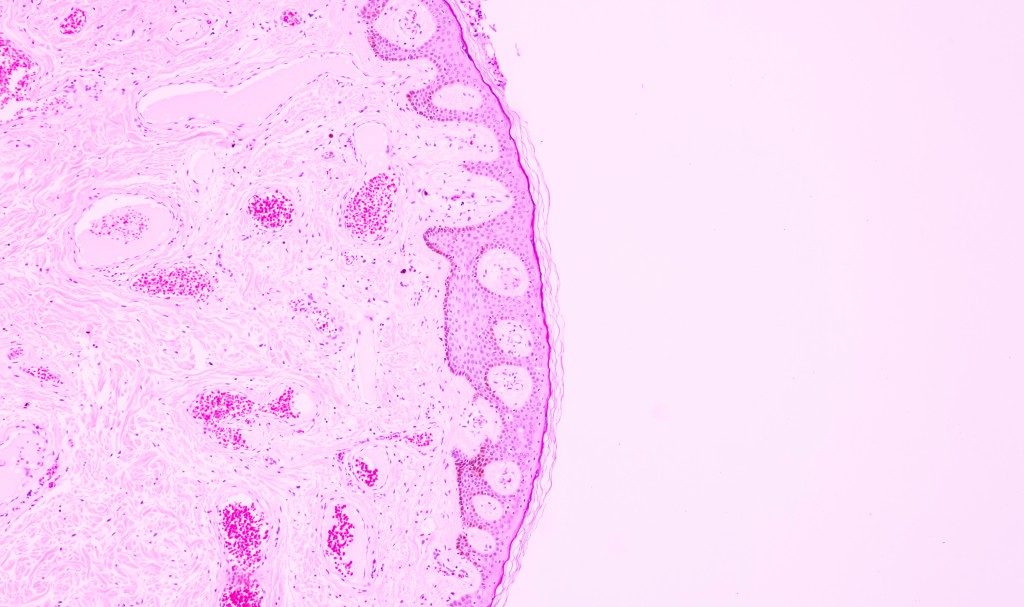 Mengungkap Rahasia Mengapa Mutasi Kanker Lebih Mudah Menyebar di Paru-paru
