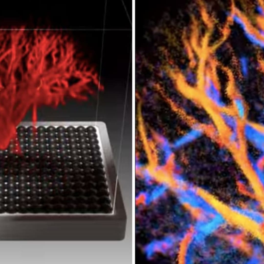 Ultrasound 4D Baru Tampilkan Aliran Darah Organ dengan Detail Mikro
