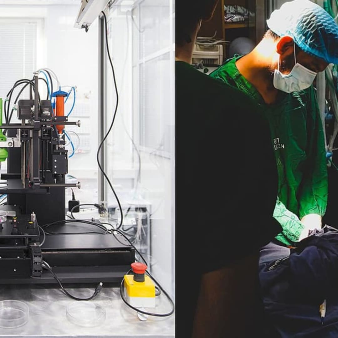 Robot Bioprinter Mini Terinspirasi Belalai Gajah Bantu Operasi Pita Suara