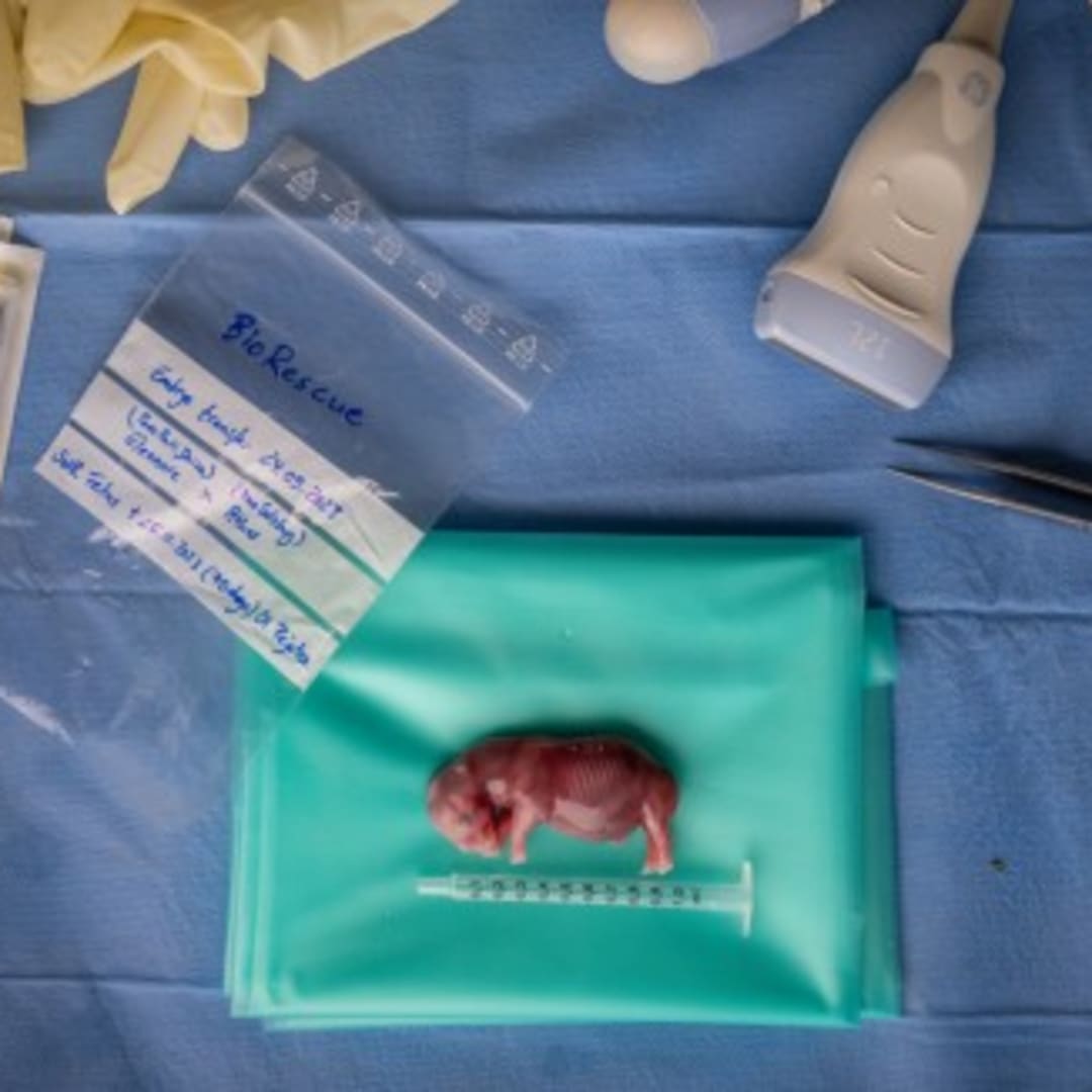 Dampak Suhu Ekstrem Perubahan Iklim terhadap Kesehatan Otak Manusia