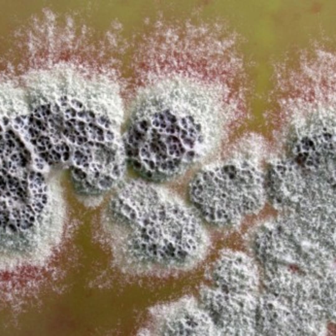 Penemuan Antibiotik Baru 100 Kali Lebih Kuat dari Obat Lama oleh Bakteri Tanah