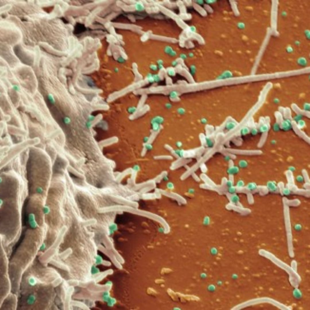 Terapi Antibodi Baru untuk Melawan Virus Flu Burung yang Bermutasi Cepat