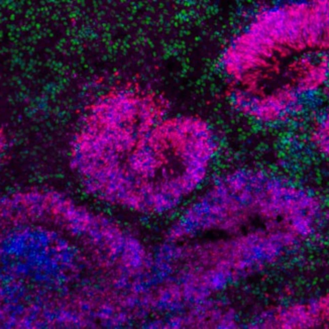 Peta Paling Detail Perkembangan Otak Manusia dari Sel Punca Embrionik