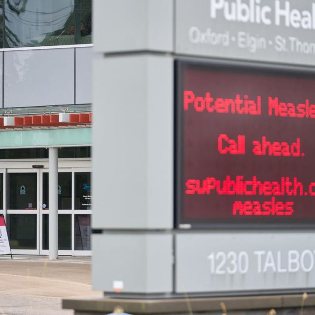 Penurunan Vaksinasi Campak Bisa Membuat AS Kehilangan Status Eliminasi