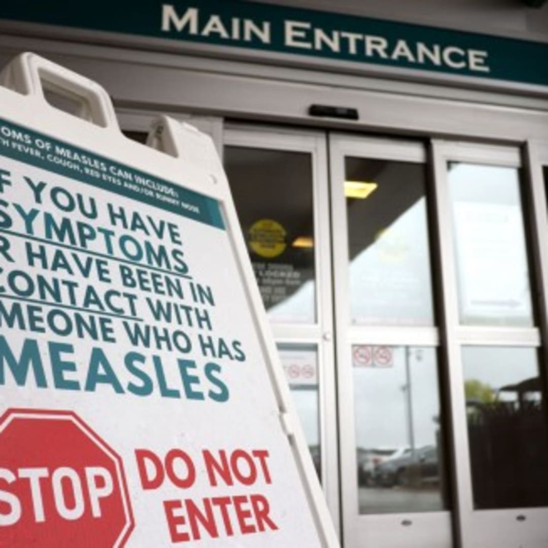 Lonjakan Kasus Campak Biarkan Kanada Kehilangan Status Bebas Campak