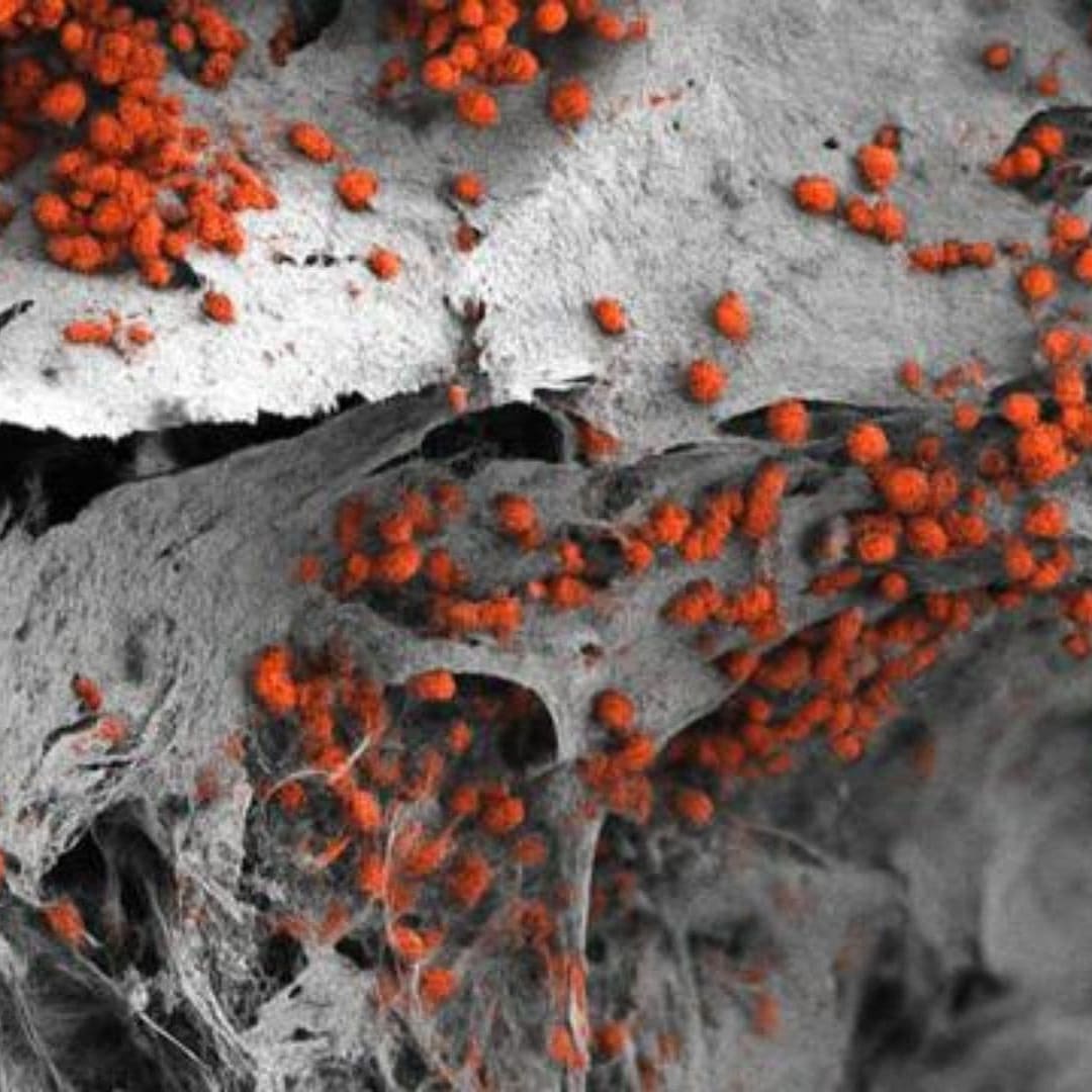 Model Sumsum Tulang Manusia Pertama dengan Sel Asli untuk Obat dan Kanker