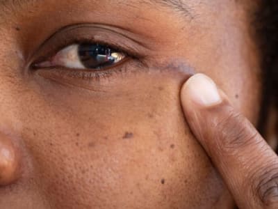 Operasi Tumor Otak Lewat Mata, Terobosan Minim Invasif Pertama di Inggris